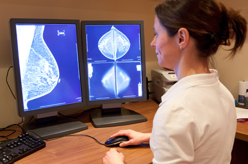 Screening gratuito per 183 donne tra i 35 e i 49 anni a Gussago